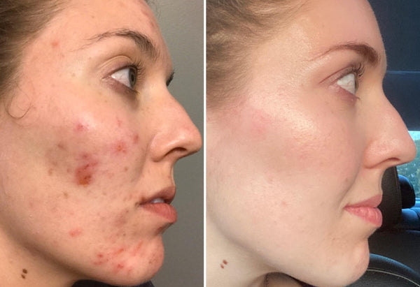 customer results
