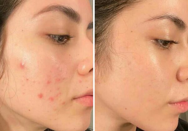 customer results