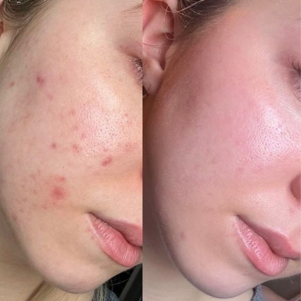 customer results