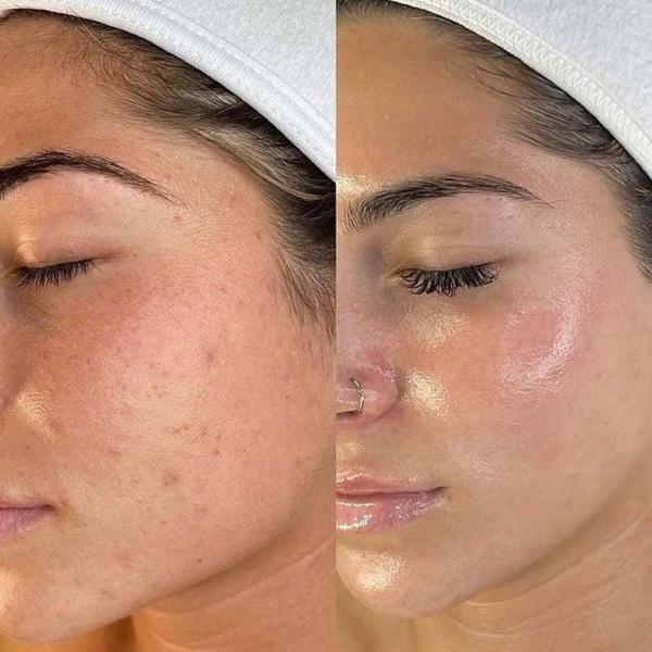customer results