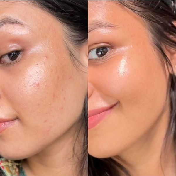 customer results