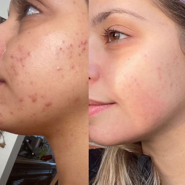 customer results