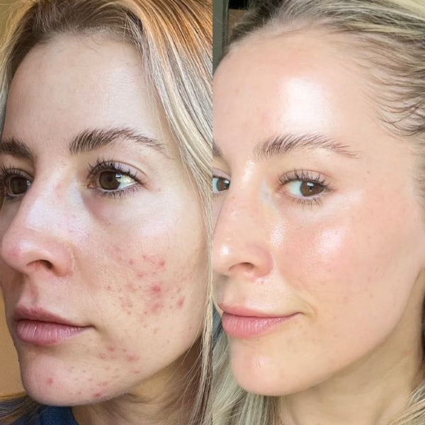 customer results