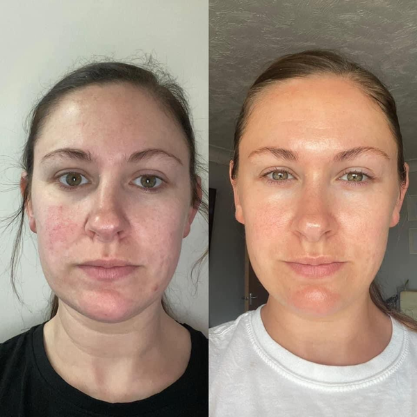 customer results