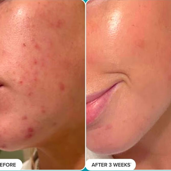 customer results