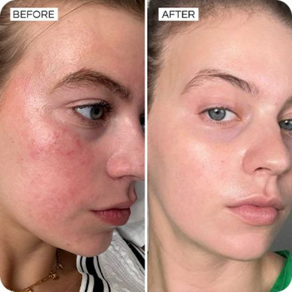 customer results
