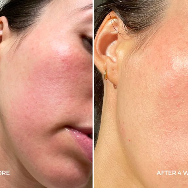customer results