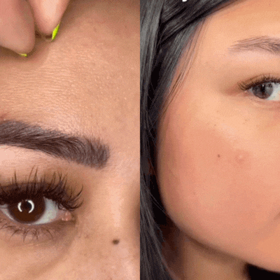 Zyntra Hydrocolloid Roll